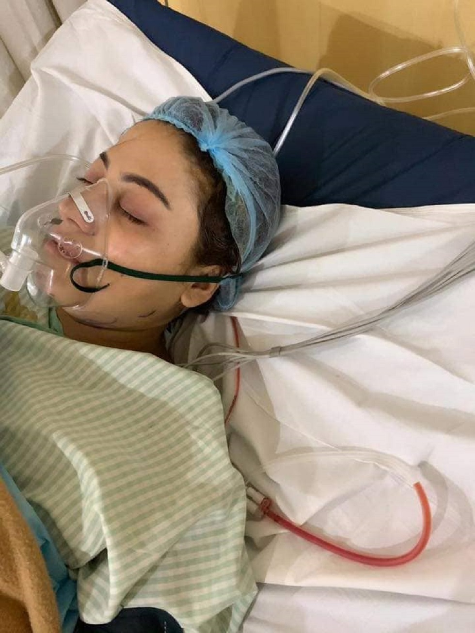 ट्यूमर देखिएपछि श्वेताको अचानक भारतमा शल्यक्रिया