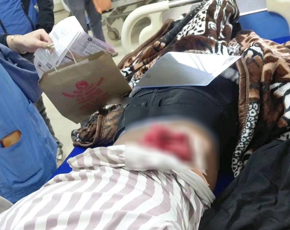 मेलामा गोली प्रहार,एक जना घाइते